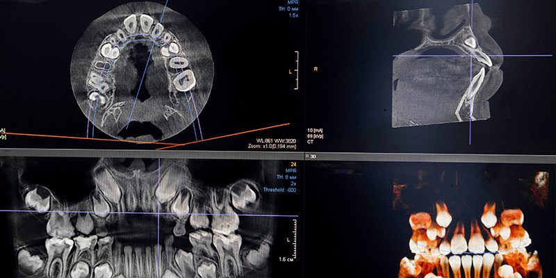 digitale_volumentomographie