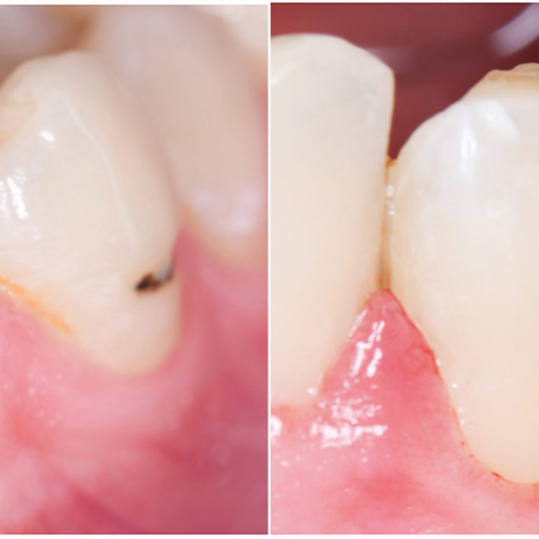 zahnheilkunde_leistung