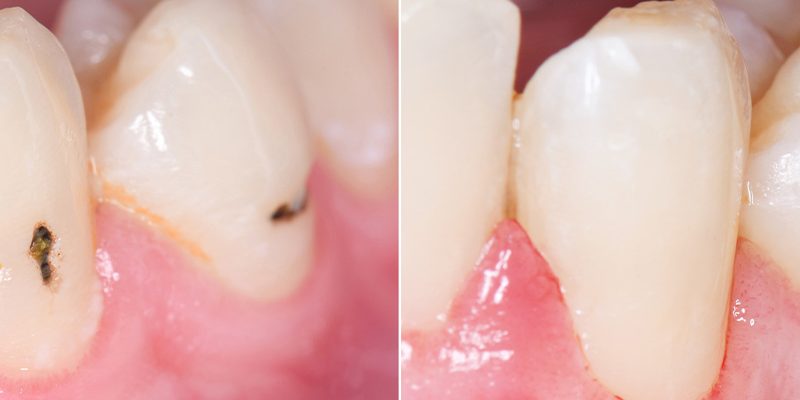 zahnheilkunde_leistung